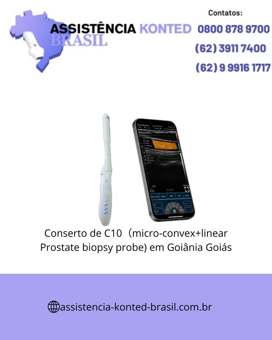 CONCERTO-ULTRASSOM-C10-MICRO-CONVEX-PROSTATE-GOIANIA-GOIAS