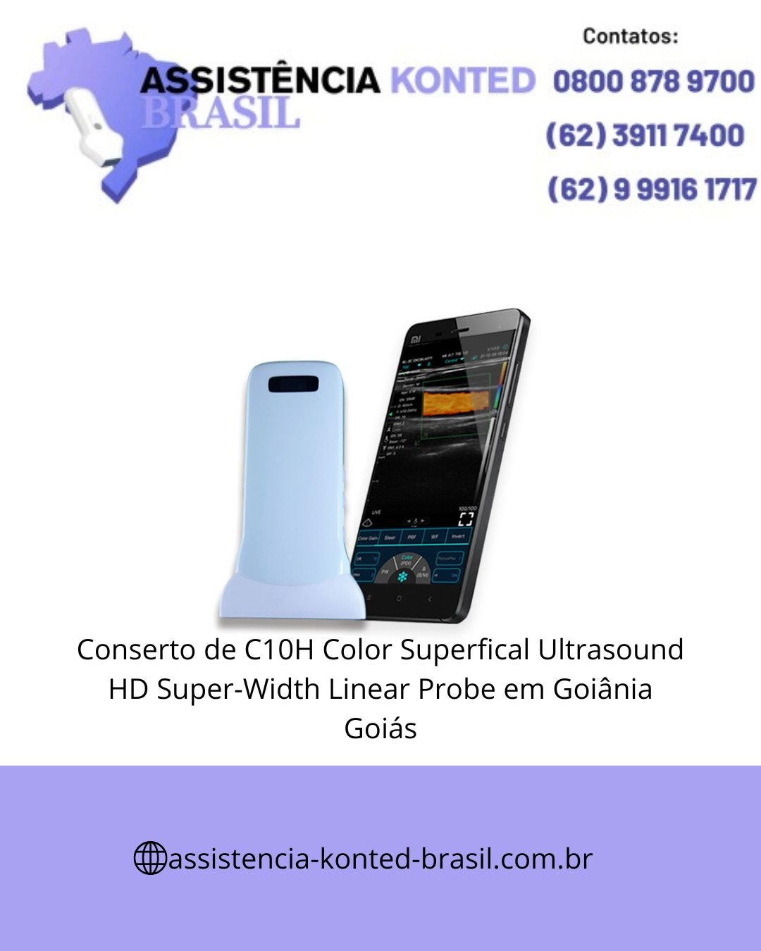CONCERTO-ULTRASSOM-C10LN-ULTRASSOM-GOIANIA-GOIAS