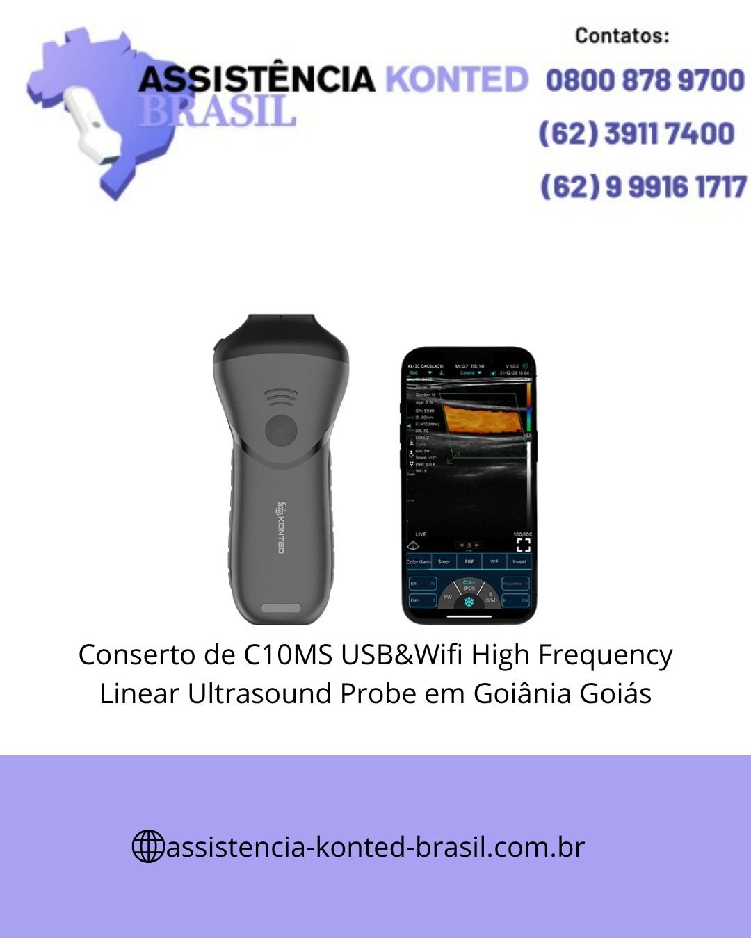 CONCERTO-ULTRASSOM-C10MS-USB-WIFI-HIGH-FREQUENCY-GOIANIA-GOIAS