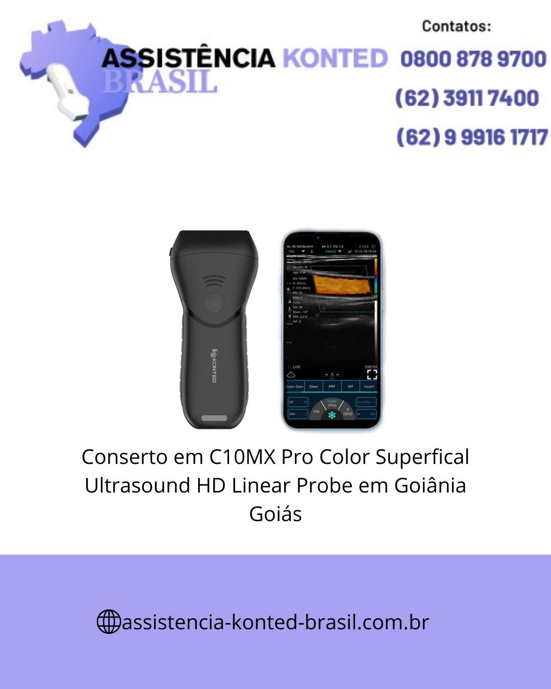 CONCERTO-ULTRASSOM-C10MX-PRO-COLOR-GOIANIA-GOIAS