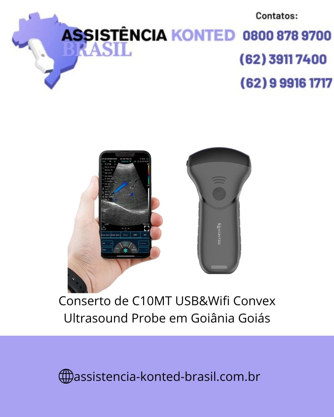 CONCERTO-ULTRASSOM-C10UR-ULTRASSOM-USB-WIFI-BASIC-CONVEX-GOIANIA-GOIAS