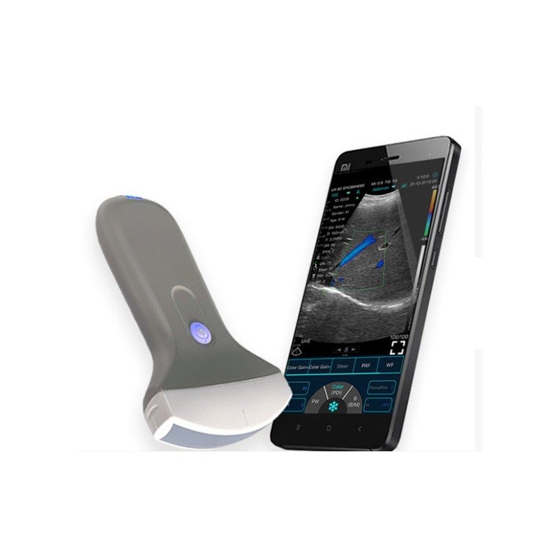 konted-ao-c10ur-sonda-de-ultrassom-usbwifi-colorida-basica-convexa-para-abdomen